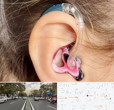 ساخت قالب سمعک در دولت 