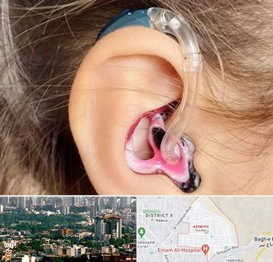 ساخت قالب سمعک در عظیمیه کرج 