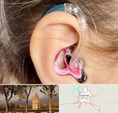 ساخت قالب سمعک در تویسرکان