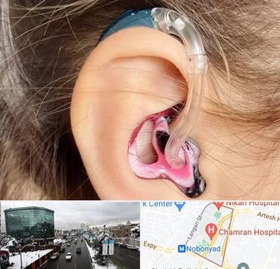 ساخت قالب سمعک در اقدسیه 