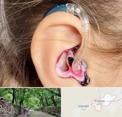 ساخت قالب سمعک در شاندیز مشهد