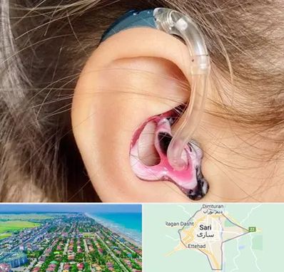 ساخت قالب سمعک در ساری