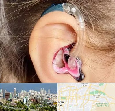 ساخت قالب سمعک در شرق تهران 