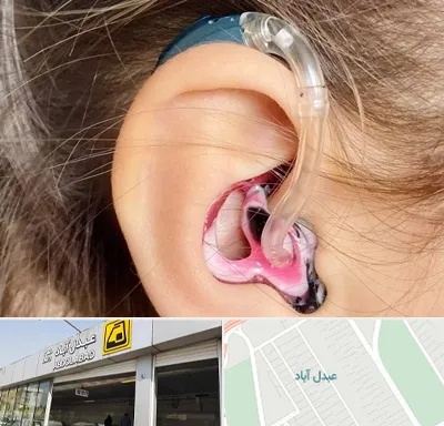 ساخت قالب سمعک در عبدل آباد