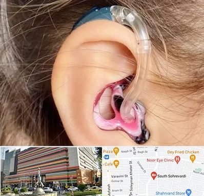 ساخت قالب سمعک در سهروردی 