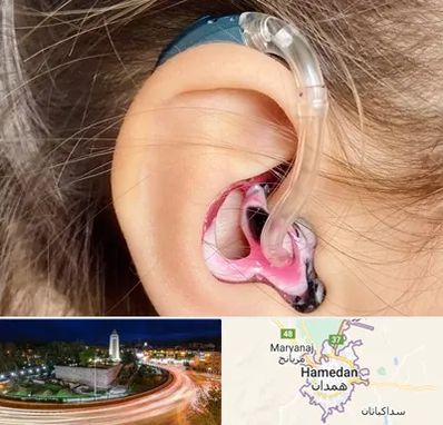 ساخت قالب سمعک در همدان