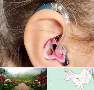 ساخت قالب سمعک در فومن