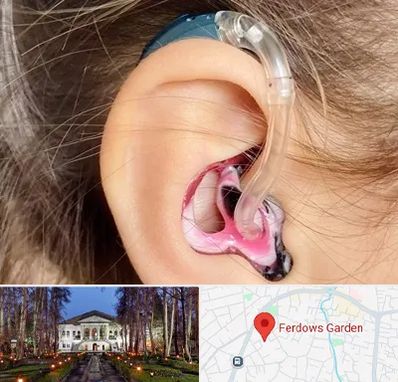 ساخت قالب سمعک در باغ فردوس