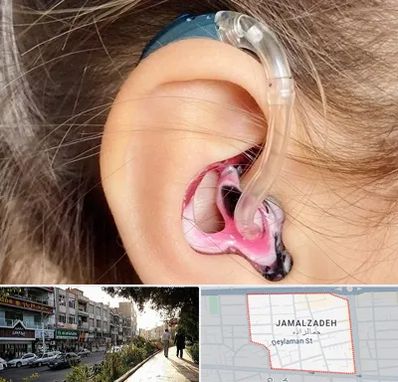 ساخت قالب سمعک در خیابان جمالزاده