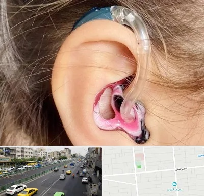 ساخت قالب سمعک در خیابان دامپزشکی