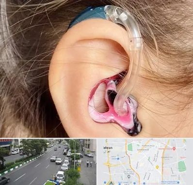 ساخت قالب سمعک در ستارخان 