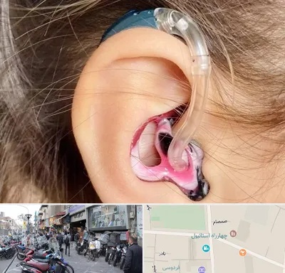 ساخت قالب سمعک در چهارراه استانبول