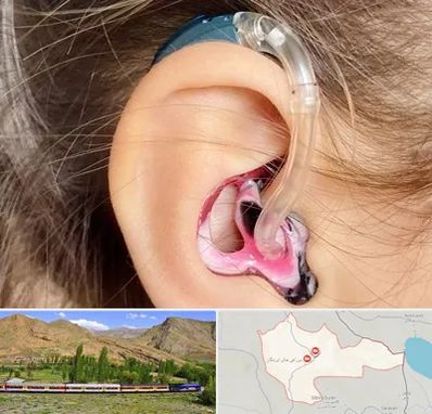 ساخت قالب سمعک در خاش