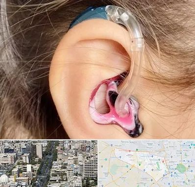 ساخت قالب سمعک در منطقه 18 تهران 