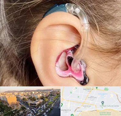 ساخت قالب سمعک در تهرانپارس 