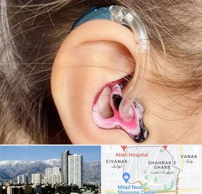 ساخت قالب سمعک در شهرک غرب 