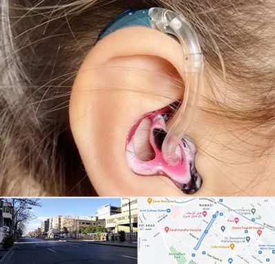 ساخت قالب سمعک در خیابان ملاصدرا شیراز 