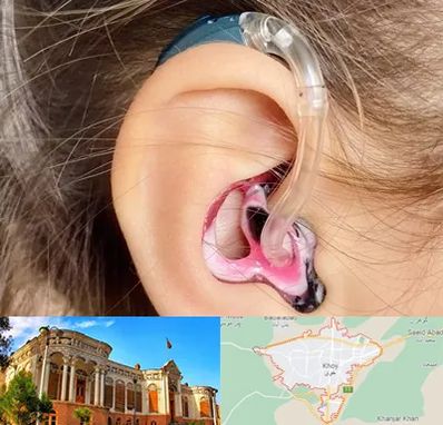 ساخت قالب سمعک در خوی