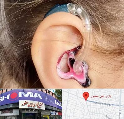 ساخت قالب سمعک در امین حضور