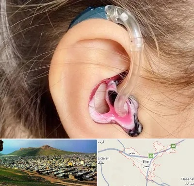 ساخت قالب سمعک در بیجار