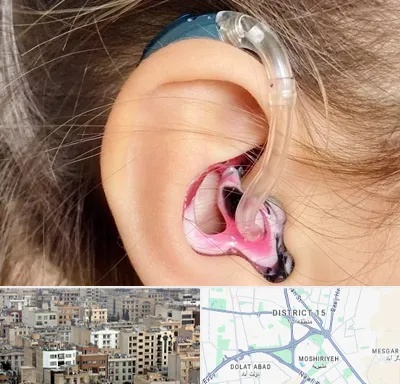 ساخت قالب سمعک در جنوب شرق تهران