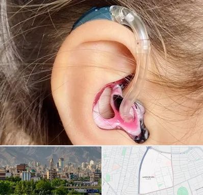 ساخت قالب سمعک در جمشیدیه