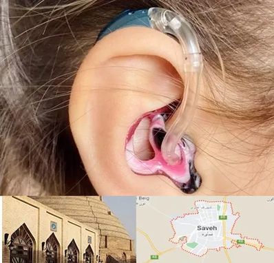 ساخت قالب سمعک در ساوه