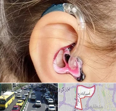 ساخت قالب سمعک در امیرآباد