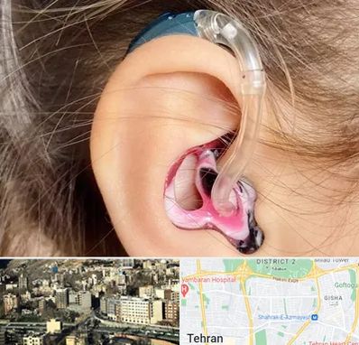 ساخت قالب سمعک در مرزداران 