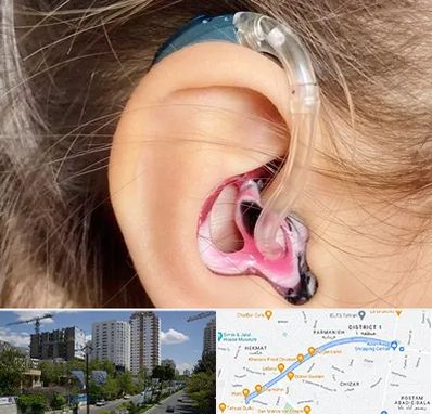 ساخت قالب سمعک در اندرزگو 