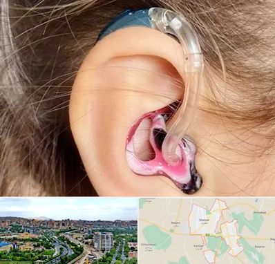 ساخت قالب سمعک در شهریار