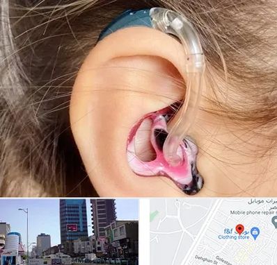 ساخت قالب سمعک در چهارراه طالقانی کرج 