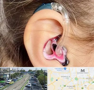 ساخت قالب سمعک در جنوب تهران 