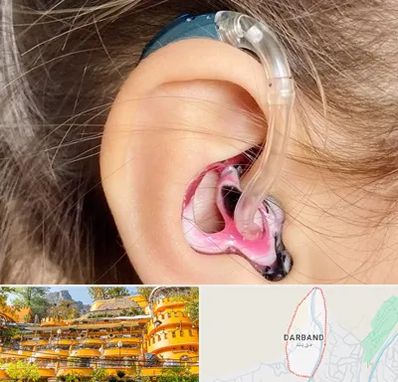 ساخت قالب سمعک در دربند