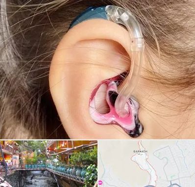 ساخت قالب سمعک در درکه