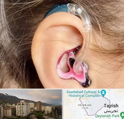 ساخت قالب سمعک در زعفرانیه 