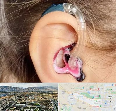 ساخت قالب سمعک در منطقه 21 تهران 