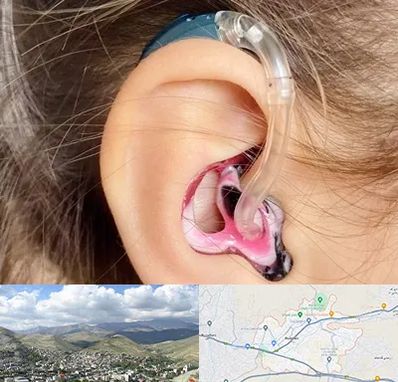 ساخت قالب سمعک در رودهن