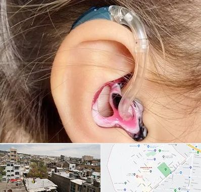 ساخت قالب سمعک در شمیران نو 