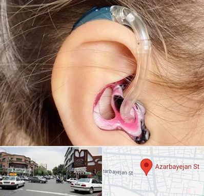 ساخت قالب سمعک در خیابان آذربایجان