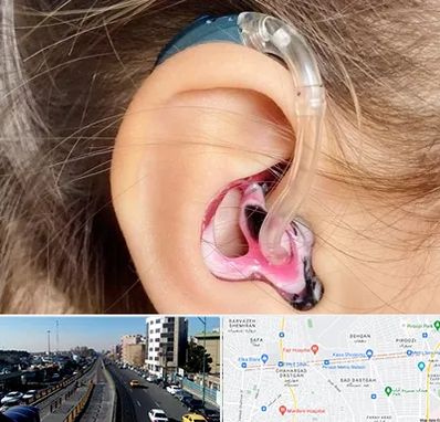 ساخت قالب سمعک در پیروزی 