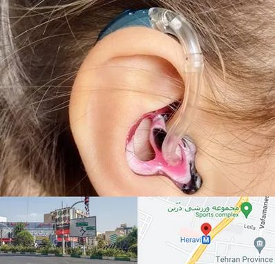 ساخت قالب سمعک در هروی 