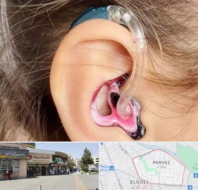 ساخت قالب سمعک در پرواز تبریز