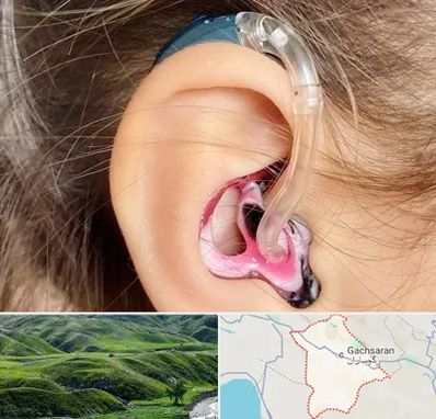 ساخت قالب سمعک در گچساران