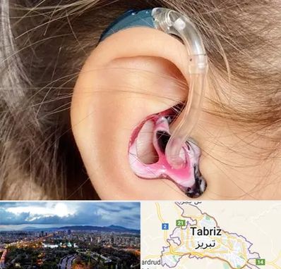 ساخت قالب سمعک در تبریز