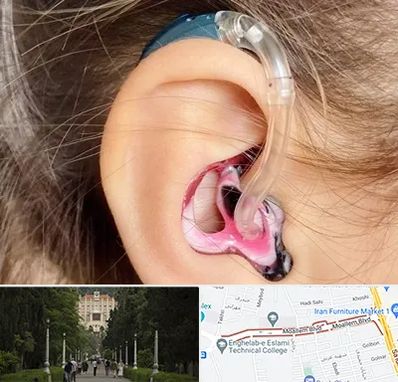 ساخت قالب سمعک در بلوار معلم رشت 