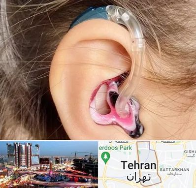 ساخت قالب سمعک در صادقیه 