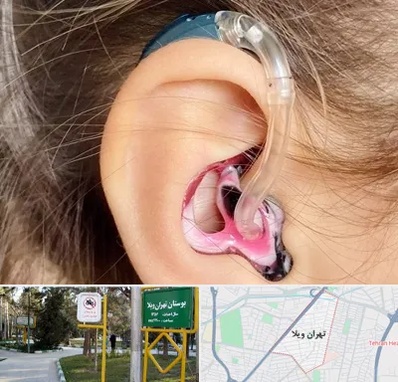 ساخت قالب سمعک در تهران ویلا
