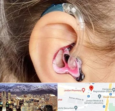 ساخت قالب سمعک در جردن 