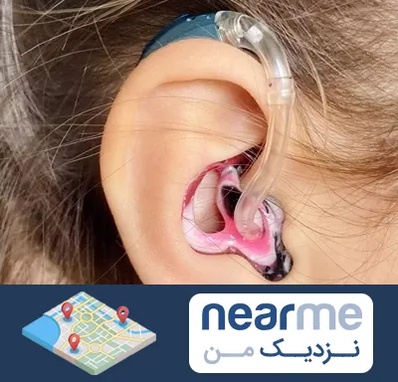 ساخت قالب سمعک در نزدیک من